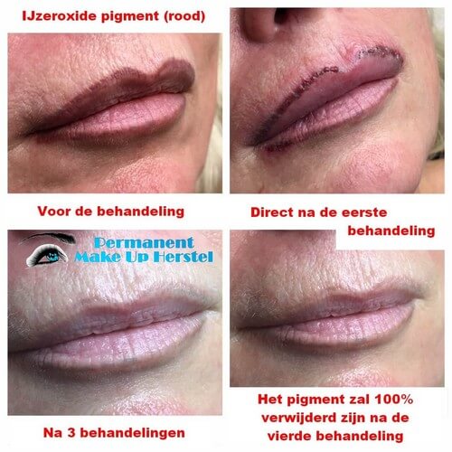 Rood geworden IJzeroxide pigment in de lippen verwijderen